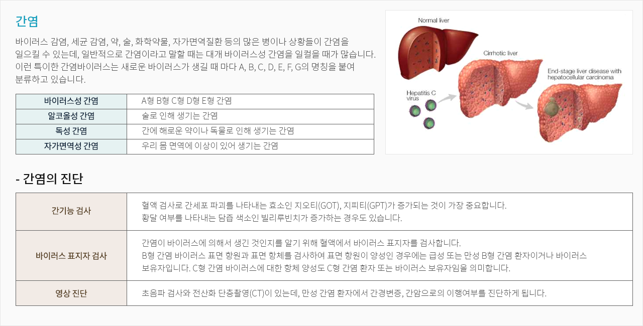 간염
