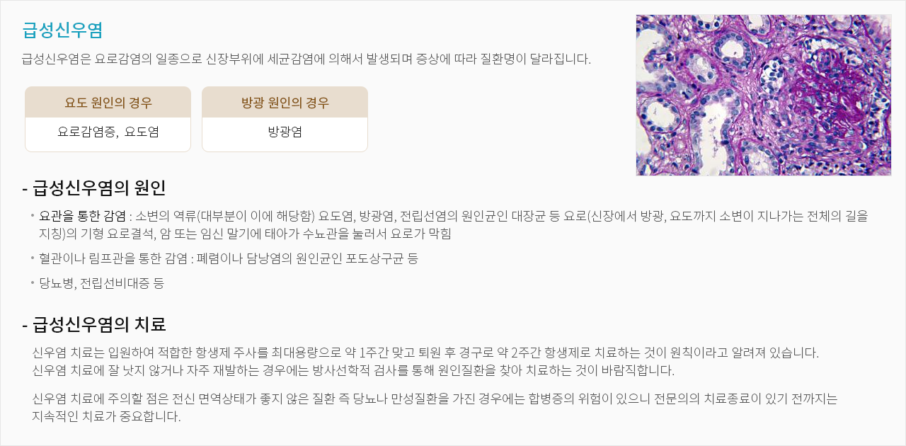 급성신우염